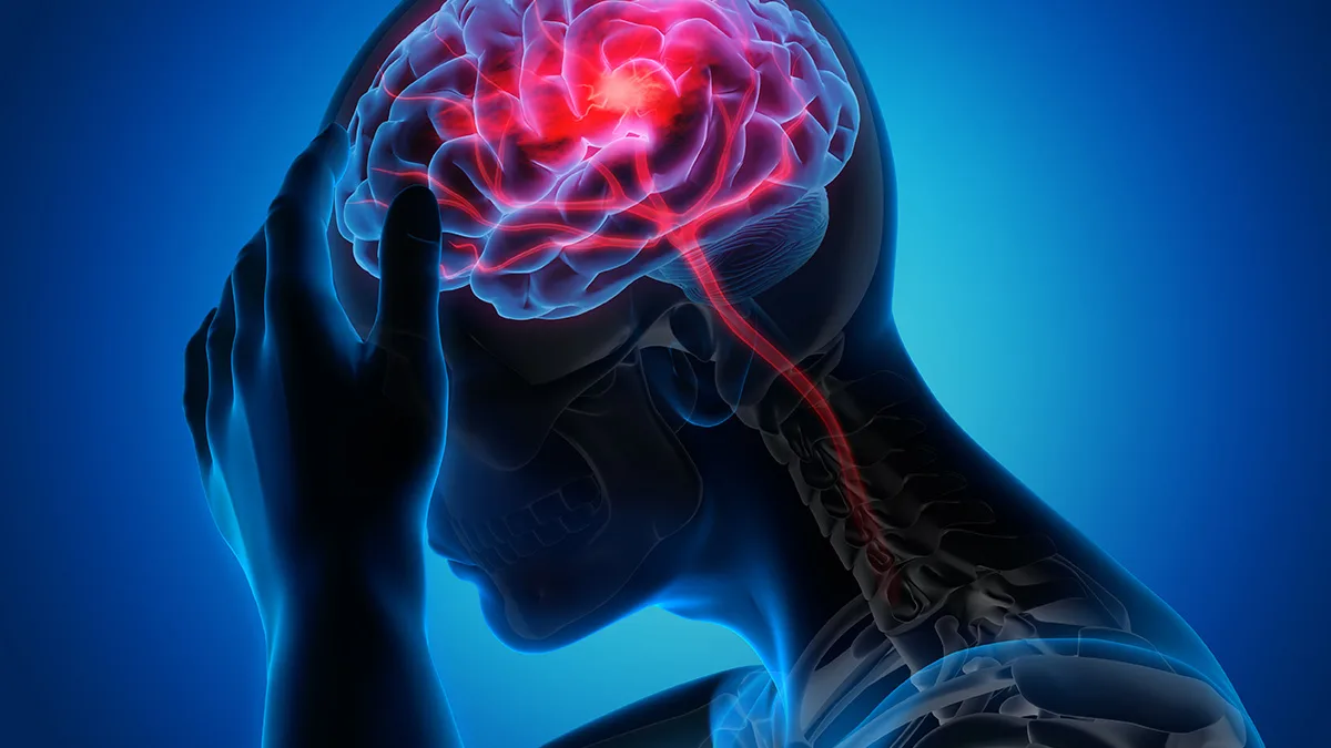 هوش مصنوعی جدید دانشمندان با تحلیل DNA میتواند ریسک سکته مغزی را پیشبینی کند